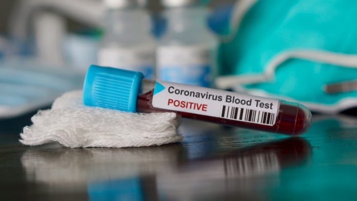Koronavirus sa siri WHO vyhlasila globalny stav zdravotnej nudze Britania opusta EU